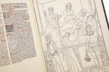 Johannes de Ketham: Fasciculus Medicinae – Editions Medicina Rara – Museum Otto Schäfer (Schweinfurt, Germany) Johannes de Ketham: Fasciculus Medicinae – Editions Medicina Rara – Museum Otto Schäfer (Schweinfurt, Germany)