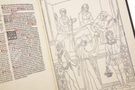 Johannes de Ketham: Fasciculus Medicinae – Editions Medicina Rara – Museum Otto Schäfer (Schweinfurt, Germany) Johannes de Ketham: Fasciculus Medicinae – Editions Medicina Rara – Museum Otto Schäfer (Schweinfurt, Germany)